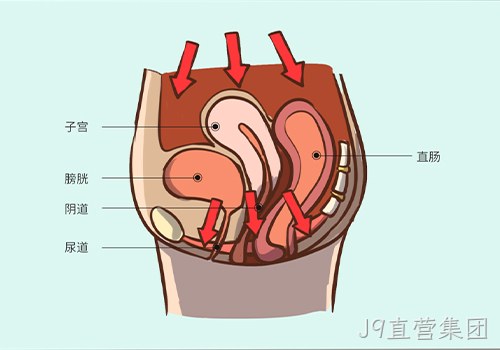 助力女性盆底功能健康发展，J9直营集团推出高频评估电灼仪